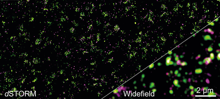 Die Verteilung des Glutamat-Rezeptors mGluR4 und anderer Proteine in der präsynaptischen Membran. Links ein hochaufgelöstes dSTORM-Bild. Rechts das Ergebnis, das mit konventioneller Fluoreszenzmikroskopie zu erreichen ist – molekulare Details sind hier nicht zu erkennen.