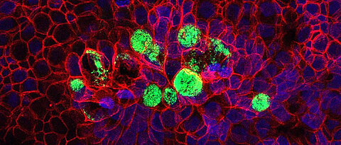 Mit Hilfe von Gewebemodelle lassen sich die angeborene sowie die erworbene Immunität erforschen. Hier zu sehen ist ein mit Bakterien (grün) infiziertes Gewebemodell von humanen Eileiterzellen. (Bild: Pargev Hovhannisyan) 