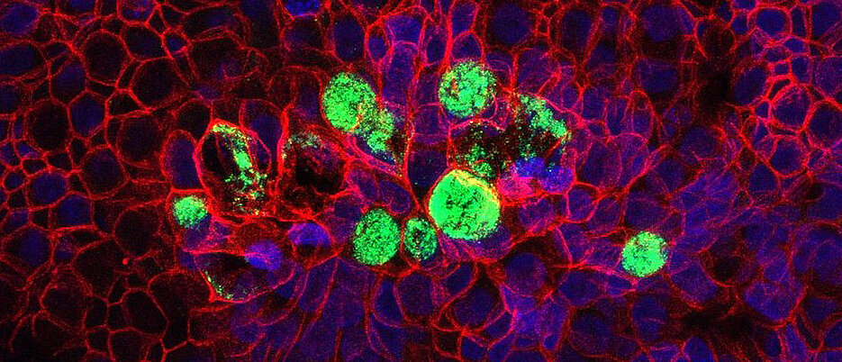 Mit Hilfe von Gewebemodelle lassen sich die angeborene sowie die erworbene Immunität erforschen. Hier zu sehen ist ein mit Bakterien (grün) infiziertes Gewebemodell von humanen Eileiterzellen. (Bild: Pargev Hovhannisyan) 