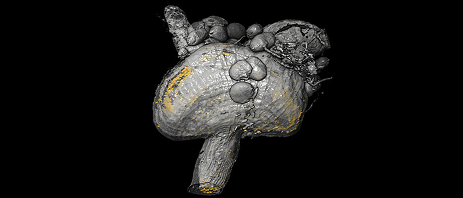 3D-Modell des Proventrikulus, eines speziellen Organs der Tsetsefliege: Die Verteilung der Trypanosomen ist anhand der fluoreszierenden Zellkerne in Gelb visualisiert. (Bild: Lehrstuhl Zoologie I/eLife)