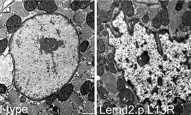 Elektronenmikroskopische Aufnahmen der Zellkerne von Herzmuskelzellen eines wildtypischen Mausherzen (links) sowie einem Herzen mit der LEMD2 Mutation (rechts). Die Einstülpungen der Zellkernmembran sind rechts deutlich sichtbar. 