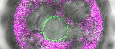 In this multicellular Volvox alga, the novel light sensor 2c-cyclop was labeled with fluorescence (green). It shows up in membranes around the nucleus. (Image: Eva Laura von der Heyde)