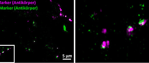 Synapsen von Gehirnzellen, mit konventioneller Fluoreszenzmarkierung auf Antikörperbasis sichtbar gemacht: Die Pre-Synapsen (rot) und die Post-Synapsen (grün) erscheinen leicht unscharf; der synaptische Spalt ist nicht vollständig aufgelöst. (Bild: Fr