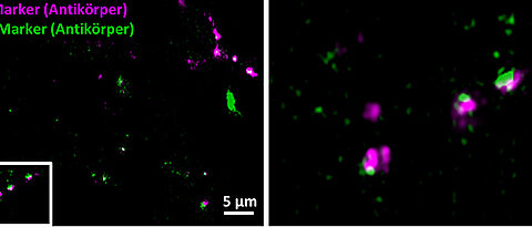 Synapses of brain cells