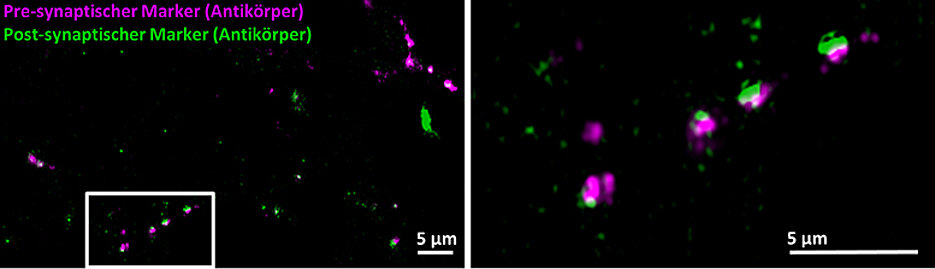 Synapses of brain cells