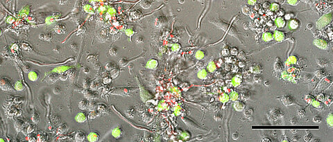 Von Monozyten abgeleitete dendritische Zellen nach einer Infektion mit dem Zytomegalievirus (grün) und dem Schimmelpilz Aspergillus fumigatus (rot). Fluoreszenzmikroskopie, Maßstab 100 µm.