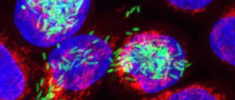 A new method developed at the University of Würzburg allows researchers to shed light on the details of what happens in pathogens and affected host cells during an infection. The image shows human cells (red/blue) infected with Salmonella (green).