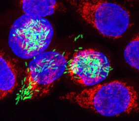 A new method developed at the University of Würzburg allows researchers to shed light on the details of what happens in pathogens and affected host cells during an infection. The image shows human cells (red/blue) infected with Salmonella (green).