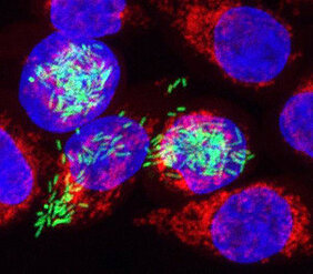 Mit einer an der Universität Würzburg entwickelten neuen Methode können Forscher weit detaillierter als bisher nachvollziehen, was bei Infektionen in Krankheitserregern und den von ihnen befallenen Zellen vor sich geht. Das Foto zeigt menschliche Zelle