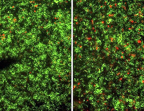 Eine fluoreszenzmikroskopische Aufnahme eines Mauslymphknotens zeigt, dass die Behandlung mit STAR2 (rechts) die Anzahl der regulatorischen T Zellen (rot) deutlich vermehrt. (Foto: A. Beilhack / Uniklinikum Würzburg)