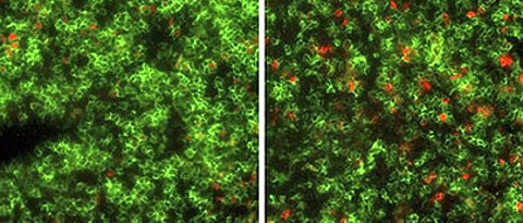 Eine fluoreszenzmikroskopische Aufnahme eines Mauslymphknotens zeigt, dass die Behandlung mit STAR2 (rechts) die Anzahl der regulatorischen T Zellen (rot) deutlich vermehrt. (Foto: A. Beilhack / Uniklinikum Würzburg)