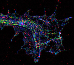 Hochauflösende Mikroskopie einer Axonterminale eines kultivierten Motoneurons: Mikrotubuli sind mit grünem Fluoreszenzfabstoff gefärbt, Stathmin in blau,  Stat-3 in rot. (Abbildung: Preeti Yadav, Michael Sendtner, Markus Sauer, Universität Würzburg).