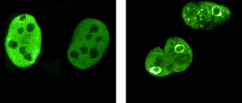 MYC proteins are coloured green in this figure. In normally growing cells, they are homogeneously distributed in the cell nucleus (left). In diverse stress situations, as they occur in cancer cells, they rearrange themselves, form sphere-like structures and thus surround particularly vulnerable sections of the genome.