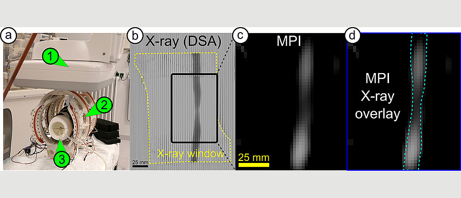 The iMPI scanner (left) provides new insights into the human body. Here you can see a constriction in a blood vessel - recorded with conventional X-rays (b), with the scanner (c) and in a combination of both techniques (d). 