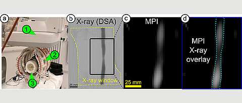 The iMPI scanner (left) provides new insights into the human body. Here you can see a constriction in a blood vessel - recorded with conventional X-rays (b), with the scanner (c) and in a combination of both techniques (d). 