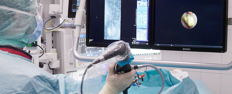Den Stein im Blick: Bei der flexiblen Harnleiter- und Nierenspiegelung (URS) kann der Operateur mittels Röntgen (linker Bildschirm) und hochauflösender Kamera (rechter Bildschirm) im Operationsfeld genau navigieren, um auch schwierig gelegene Nierensteine aufzuspüren.