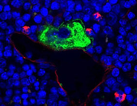 Mikroskopaufnahme von intaktem Knochenmarkgewebe von Mäusen. Im normalen Zustand lagern sich die reifen Megakaryozyten (grün) im Knochenmark an die Gefäßwand (rot) an und geben ihre neuen Blutplättchen zielgerichtet in die Blutbahn ab. Zellkerne sind