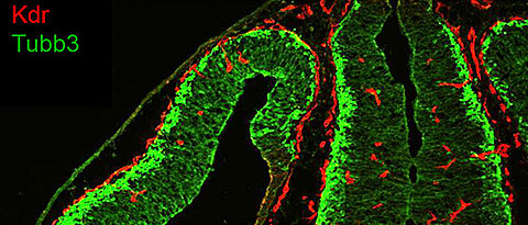 Distribution of endothelial cells (red) and neuronal cells (green) in the brain of adult mice. (Photo: team Gessler)