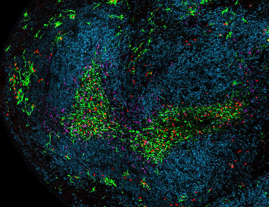 Microscopic image showing a part of the spleen during chronic viral infection. Dendritic cells are green, Killer T cells are red, B cells are blue and stromal cells are magenta.