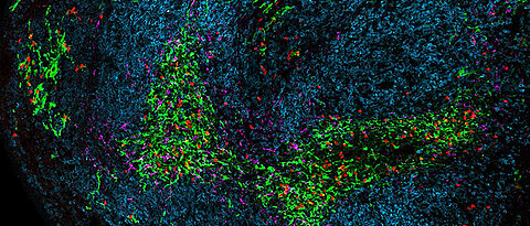 Microscopic image showing a part of the spleen during chronic viral infection. Dendritic cells are green, Killer T cells are red, B cells are blue and stromal cells are magenta.