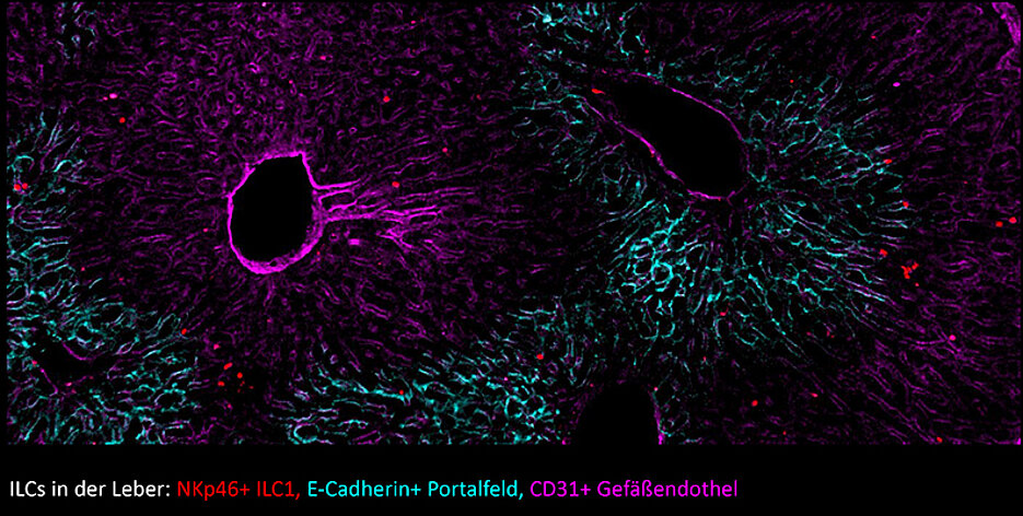 Liver tissue with innate lymphoid cells (ILCs), visualised here as red dots.