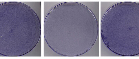 Colonies of colon cancer cells cultured in absence of glutamine for 48 hours. The cells die in presence of high exogenous levels of MYC (middle, MYC-ER) compared to the control (EV, left). 