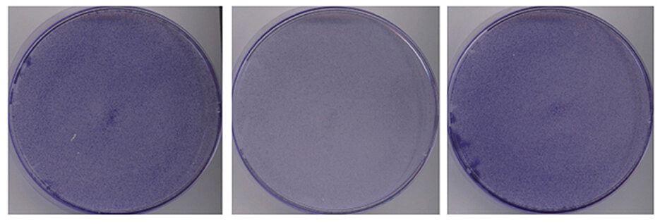 Colonies of colon cancer cells cultured in absence of glutamine for 48 hours. The cells die in presence of high exogenous levels of MYC (middle, MYC-ER) compared to the control (EV, left). 