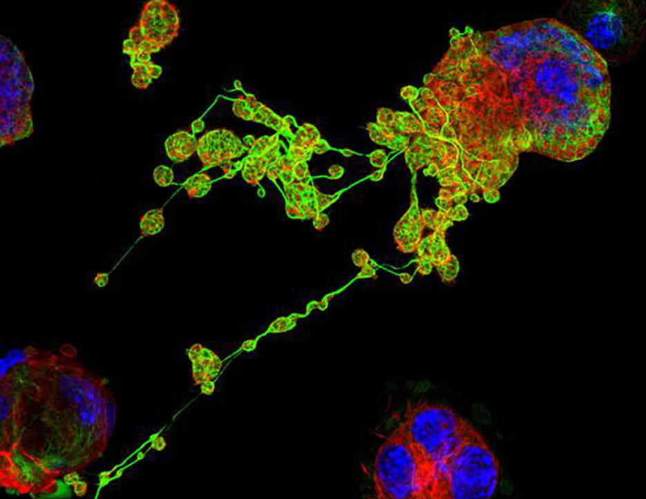 Mikroskopaufnahme (Immunfluoreszenz) eines Megakaryozyten im Prozess der Blutplättchenbildung (Thrombopoese). Lange Ausläufer (sog. proplatelets) sind durch ein hoch strukturiertes Zellskelett aus sog. Mikrotubuli (grün) und Aktinfilamenten (rot) chara