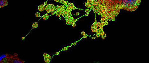 Mikroskopaufnahme (Immunfluoreszenz) eines Megakaryozyten im Prozess der Blutplättchenbildung (Thrombopoese). Lange Ausläufer (sog. proplatelets) sind durch ein hoch strukturiertes Zellskelett aus sog. Mikrotubuli (grün) und Aktinfilamenten (rot) chara