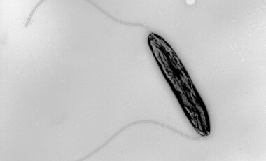 Der Lebensmittelkeim Campylobacter jejuni in einer Transmissionsemissionsmikroskop-Detailaufnahme. Das Bakterium trägt zwei fadenförmige Strukturen, die sogenannten Flagellen, mit denen es sich fortbewegen kann.