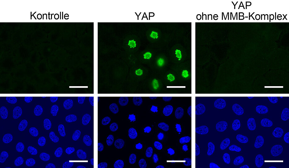 Zellen teilen sich nach der Aktivierung von YAP (grüne Färbung) – aber nur, wenn der MMB-Proteinkomplex intakt ist.