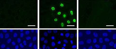 Zellen teilen sich nach der Aktivierung von YAP (grüne Färbung) – aber nur, wenn der MMB-Proteinkomplex intakt ist.