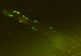 Wurzelhaar einer Pflanze mit angreifenden Bakterien (grün). Foto: Dirk Becker