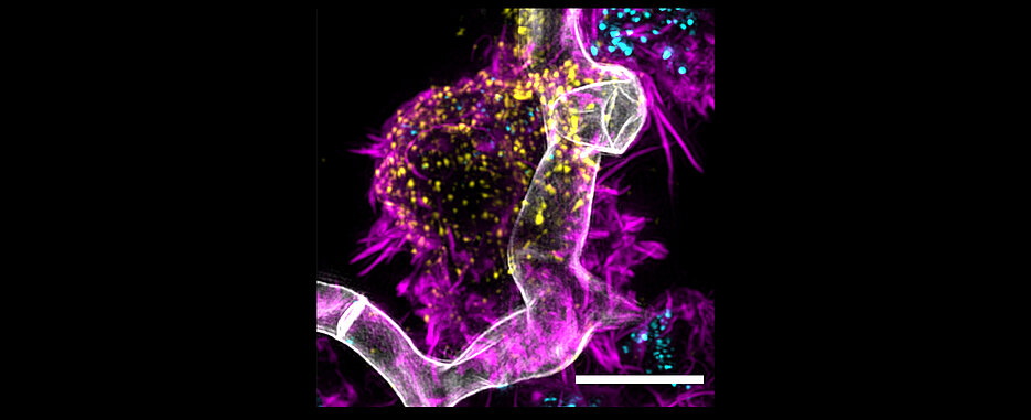 Die mikroskopische Aufnahme von Nora Trinks vom Lehrstuhl für Biotechnologie und Biophysik an der Universität Würzburg zeigt eine von Michelle Seif präparierte Pilz-CAR-T-Zell-Interaktion; in grau gefärbt Aspergillus fumigatus, in Magenta die CAR-T-Zellen, in Gelb die spezifischen chimären Antigenrezeptoren und in hellblau bestimmte körpereigene Botenstoffe, welche die CAR-T-Zellen bei der Interaktion mit dem Pilz produzieren und ausschütten. 