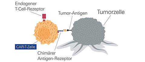Beispiel für eine vielversprechende Therapie: Die schon bei anderen Tumorerkrankungen erfolgreich eingesetzten CAR-T-Zellen lassen sich auch gegen das Multiple Myelom wenden. 