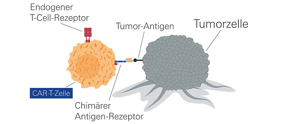 Beispiel für eine vielversprechende Therapie: Die schon bei anderen Tumorerkrankungen erfolgreich eingesetzten CAR-T-Zellen lassen sich auch gegen das Multiple Myelom wenden. 