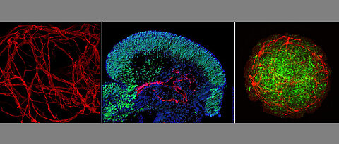 Organoidmodelle mit einer teils verblüffende Ähnlichkeit zu echten embryonalen Geweben. Hier zu sehen sind (v.l.): 3D-Rekonstruktion des Blutgefäßsystems innerhalb eines Organoids, Gehirn-Organoid mit Blutgefäßen (rot) und Gehirnstammzellen (grün) und einTumor-Organoid mit Blutgefäßen (rot) und Tumorzellen (grün). 