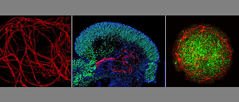 Different Organoid Models