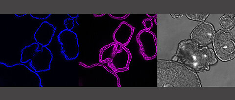Die Bilder zeigen die jeweils gleichen Magen-Organoide: Es zeigt die Zellkerne (blau) und das Skelett der Zelle (pink) als Querschnitt aus den Organoiden. In grau ist das mikroskopische Bild der Organoide. Bei diesen Magen-Organoiden ist ein einzelnes Organoid etwa ein Viertel Millimeter groß.