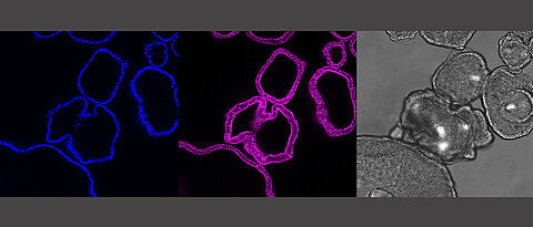 The pictures show the same gut organoids: It shows the cell nuclei (blue) and the skeleton of the cell (pink) as a cross-section of the organoids. In grey is the microscopic picture of the organoids. A single organoid here is about a quarter millimeter in size.