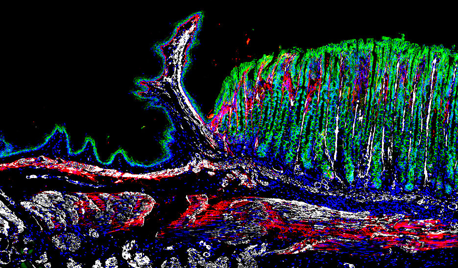 Gewebeschnitt aus dem gastroösophagealen Übergang einer Maus, der die räumliche Verteilung der verschiedenen Zelltypen durch Immunfärbung zeigt: CDH1 in grün zur Identifizierung von Epithelzellen, POSTN in rot und ACTA2 in weiß zur Abgrenzung verschiedener Fibroblasten-Subpopulationen, mit blau gefärbten Zellkernen.