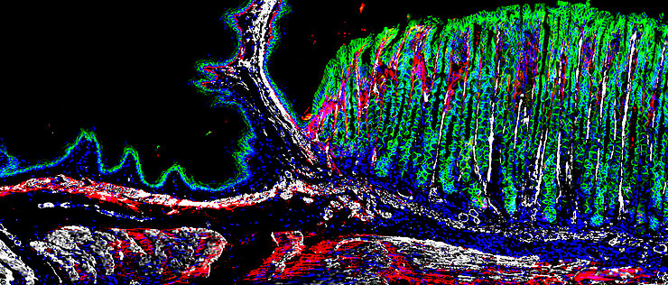 Gewebeschnitt aus dem gastroösophagealen Übergang einer Maus, der die räumliche Verteilung der verschiedenen Zelltypen durch Immunfärbung zeigt: CDH1 in grün zur Identifizierung von Epithelzellen, POSTN in rot und ACTA2 in weiß zur Abgrenzung verschiedener Fibroblasten-Subpopulationen, mit blau gefärbten Zellkernen.