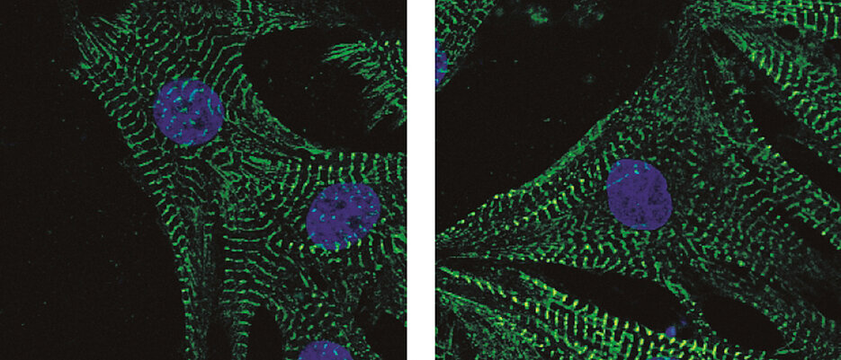 Neonatale Kardiomyozyten gefärbt mit Phalloidin: Die Abbildung zeigt Herzmuskelzellen, blau ist der Zellkern und grün das Zytoskelett.