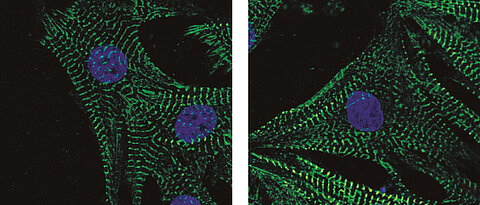 Neonatale Kardiomyozyten gefärbt mit Phalloidin: Die Abbildung zeigt Herzmuskelzellen, blau ist der Zellkern und grün das Zytoskelett.