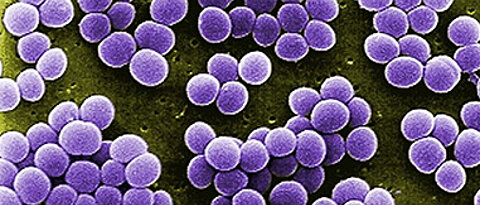 Scanning electron micrograph of S.aureus