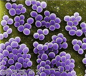 Scanning electron micrograph of S.aureus