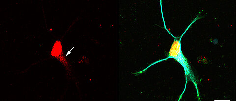 The molecule Larp7 plays an important role in the assembly of snRNP complexes. It accumulates in nerve cells (arrow) where the complexes are formed.