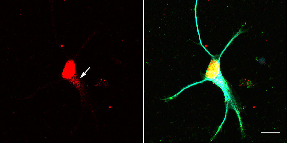 The molecule Larp7 plays an important role in the assembly of snRNP complexes. It accumulates in nerve cells (arrow) where the complexes are formed.