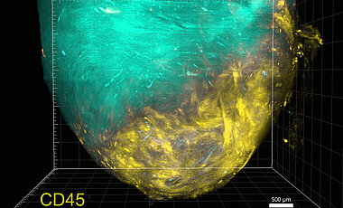 Massive Infiltration von Immunzellen in das Herz nach einem Infarkt. In Grün ist die Morphologie des Herzens zu sehen, in Gelb leuchten die Antikörper, die an das CD45-Antigen der Leukozyten gebunden haben. Die Probe wurde von Murilo Delgobo aus der AG Ramos im DZHI hergestellt und von Lisa Popiolkowski und Anne Auer mit einem Lichtblatt-Fluoreszenz-Mikroskop in der Core Unit Fluorescence Imaging am RVZ aufgenommen. 