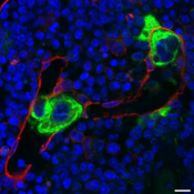 Microscope image of murine bone marrow under defective conditions.